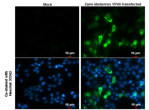 Ebola Virus VP40 Antibody in Immunocytochemistry (ICC/IF)