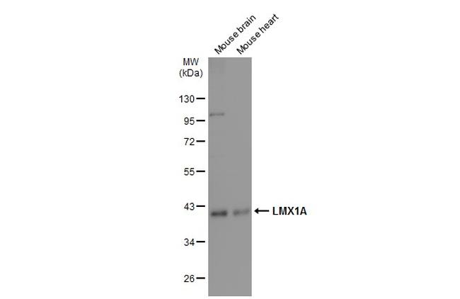 LMX1A Antibody in Western Blot (WB)