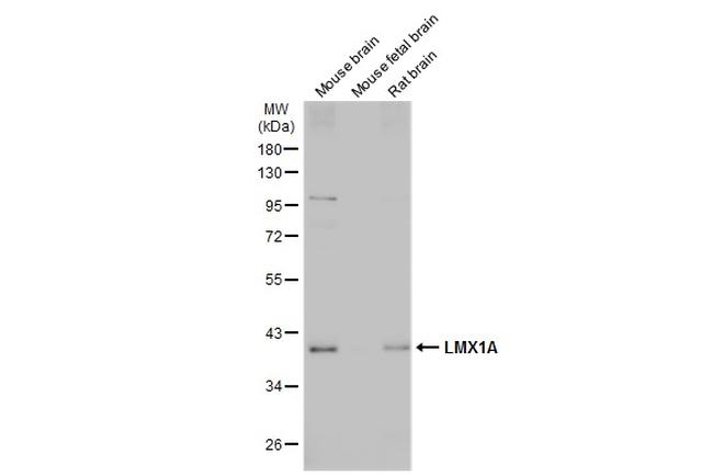 LMX1A Antibody in Western Blot (WB)