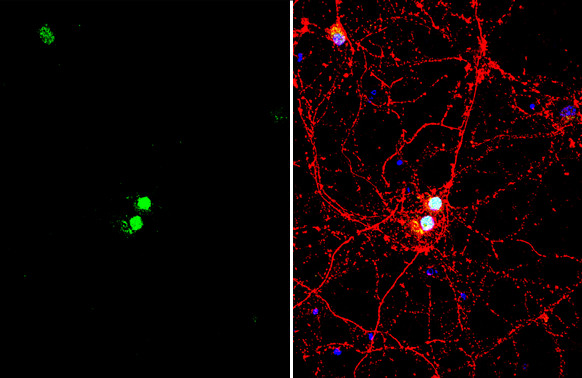 LHX3 Antibody in Immunocytochemistry (ICC/IF)