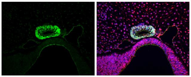 LHX3 Antibody in Immunohistochemistry (Paraffin) (IHC (P))