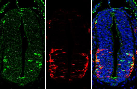 LHX3 Antibody in Immunohistochemistry (Paraffin) (IHC (P))