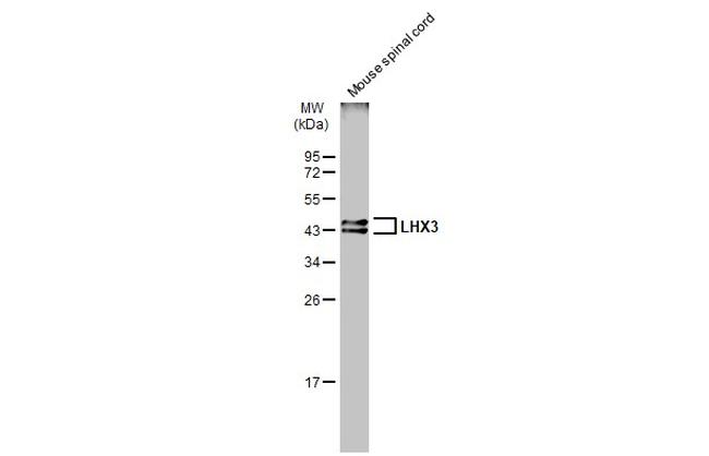 LHX3 Antibody in Western Blot (WB)