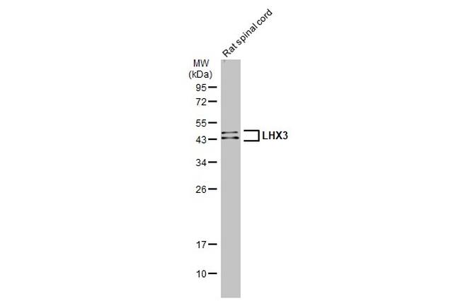 LHX3 Antibody in Western Blot (WB)