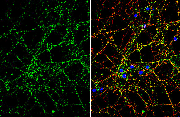 Robo2 Antibody in Immunocytochemistry (ICC/IF)