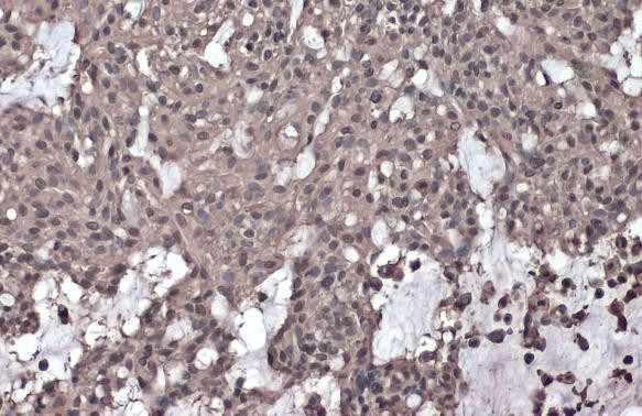 Phospho-IKK gamma (Ser376) Antibody in Immunohistochemistry (Paraffin) (IHC (P))