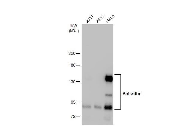 Palladin Antibody in Western Blot (WB)