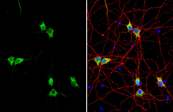 Synapsin II Antibody in Immunocytochemistry (ICC/IF)