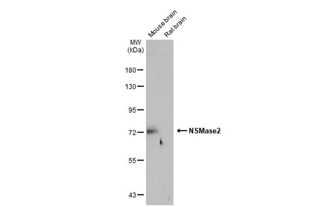 SMPD3 Antibody in Western Blot (WB)