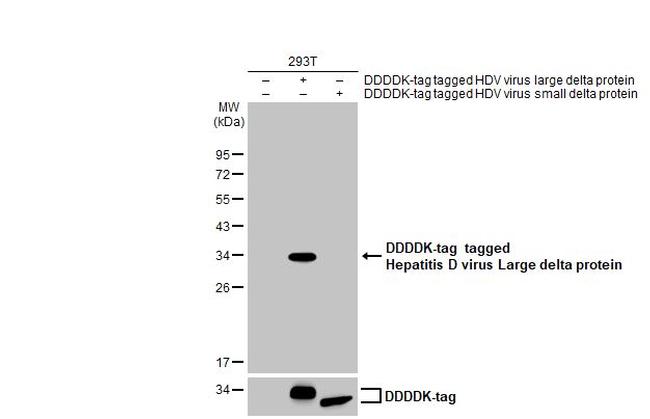 Hepatitis D Virus Large delta Protein Antibody in Western Blot (WB)