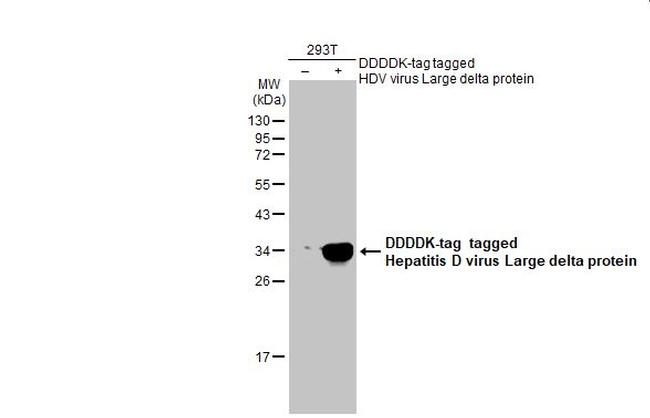 Hepatitis D Virus Large delta Protein Antibody in Western Blot (WB)