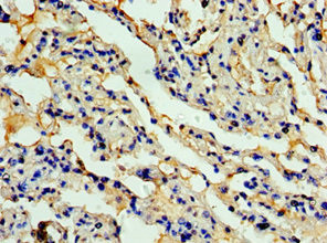 Eotaxin Antibody in Immunohistochemistry (Paraffin) (IHC (P))