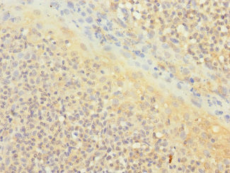 CD1c Antibody in Immunohistochemistry (Paraffin) (IHC (P))