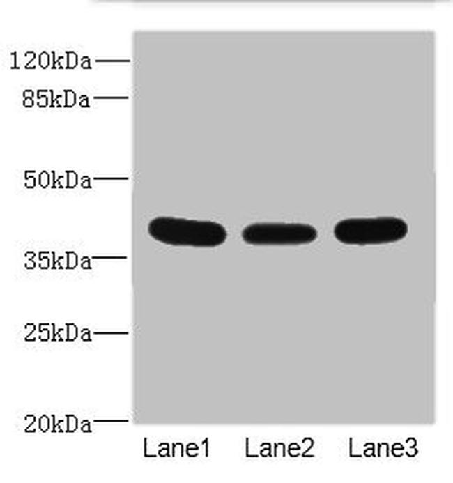 CD1c Antibody in Western Blot (WB)