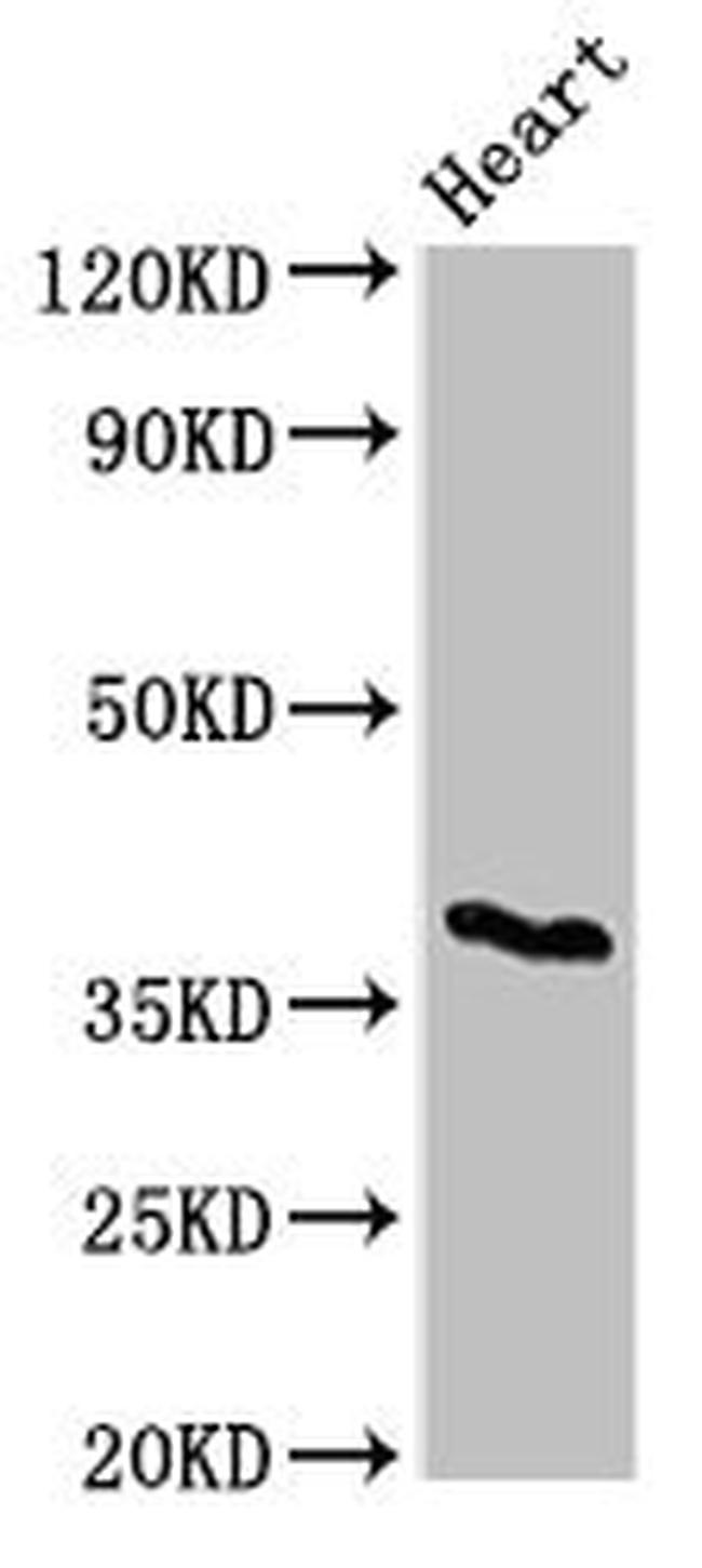 CD1c Antibody in Western Blot (WB)