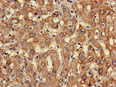 CLASP2 Antibody in Immunohistochemistry (Paraffin) (IHC (P))