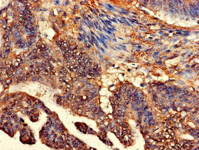 CLASP2 Antibody in Immunohistochemistry (Paraffin) (IHC (P))