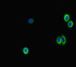 GAA Antibody in Immunocytochemistry (ICC/IF)