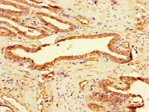 GAA Antibody in Immunohistochemistry (Paraffin) (IHC (P))