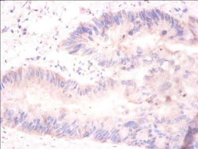 H2AFJ Antibody in Immunohistochemistry (Paraffin) (IHC (P))