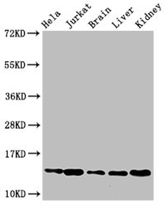 HIST1H2BB Antibody in Western Blot (WB)