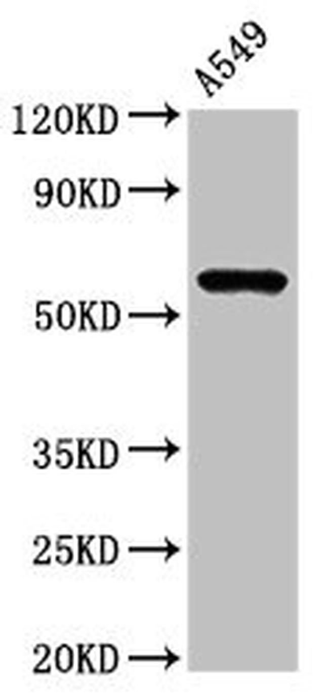 IL1R1 Antibody in Western Blot (WB)