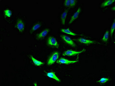 PLP1 Antibody in Immunocytochemistry (ICC/IF)