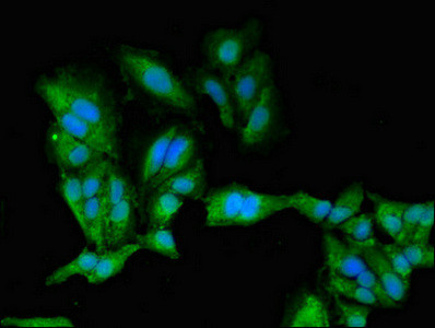 PKA beta Antibody in Immunocytochemistry (ICC/IF)