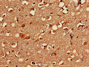 PKA beta Antibody in Immunohistochemistry (Paraffin) (IHC (P))