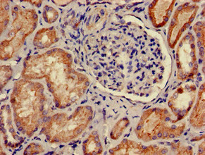 PKA beta Antibody in Immunohistochemistry (Paraffin) (IHC (P))