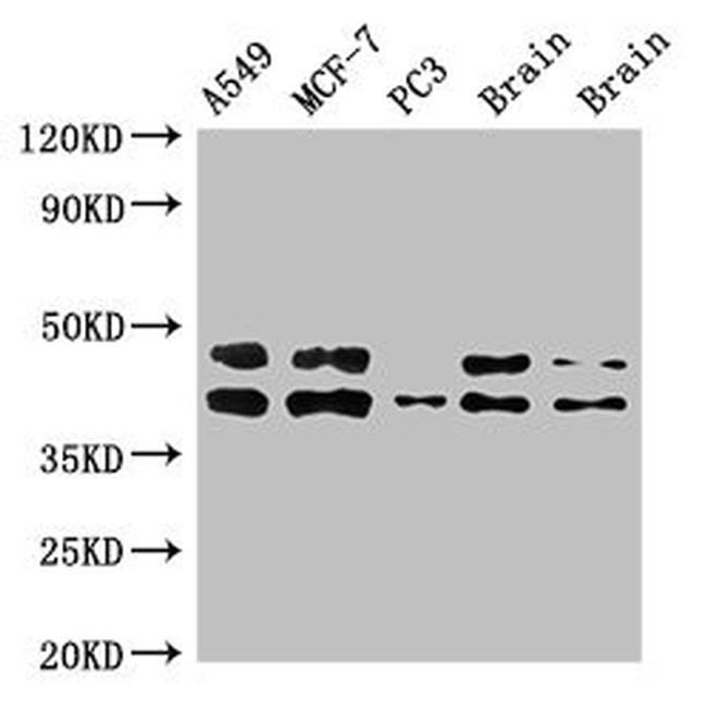 PKA beta Antibody in Western Blot (WB)