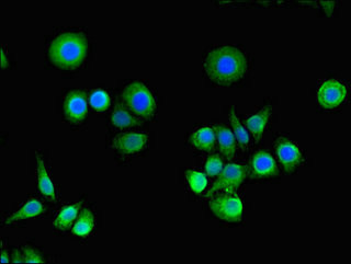 RASA1 Antibody in Immunocytochemistry (ICC/IF)