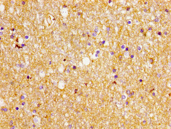 GLT-1 Antibody in Immunohistochemistry (Paraffin) (IHC (P))