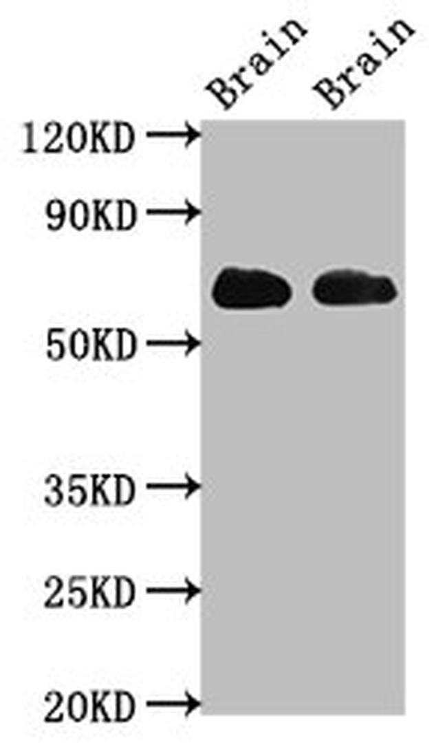 GLT-1 Antibody in Western Blot (WB)