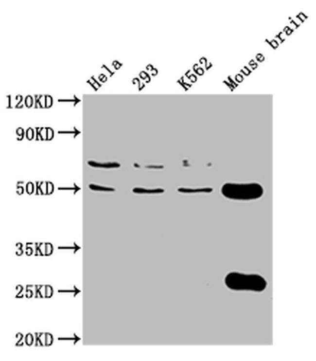 TUBB4A Antibody in Western Blot (WB)