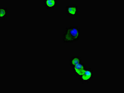 TUBB4A Antibody in Immunocytochemistry (ICC/IF)