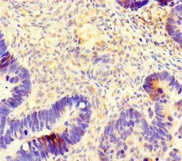 TUBB4A Antibody in Immunohistochemistry (Paraffin) (IHC (P))