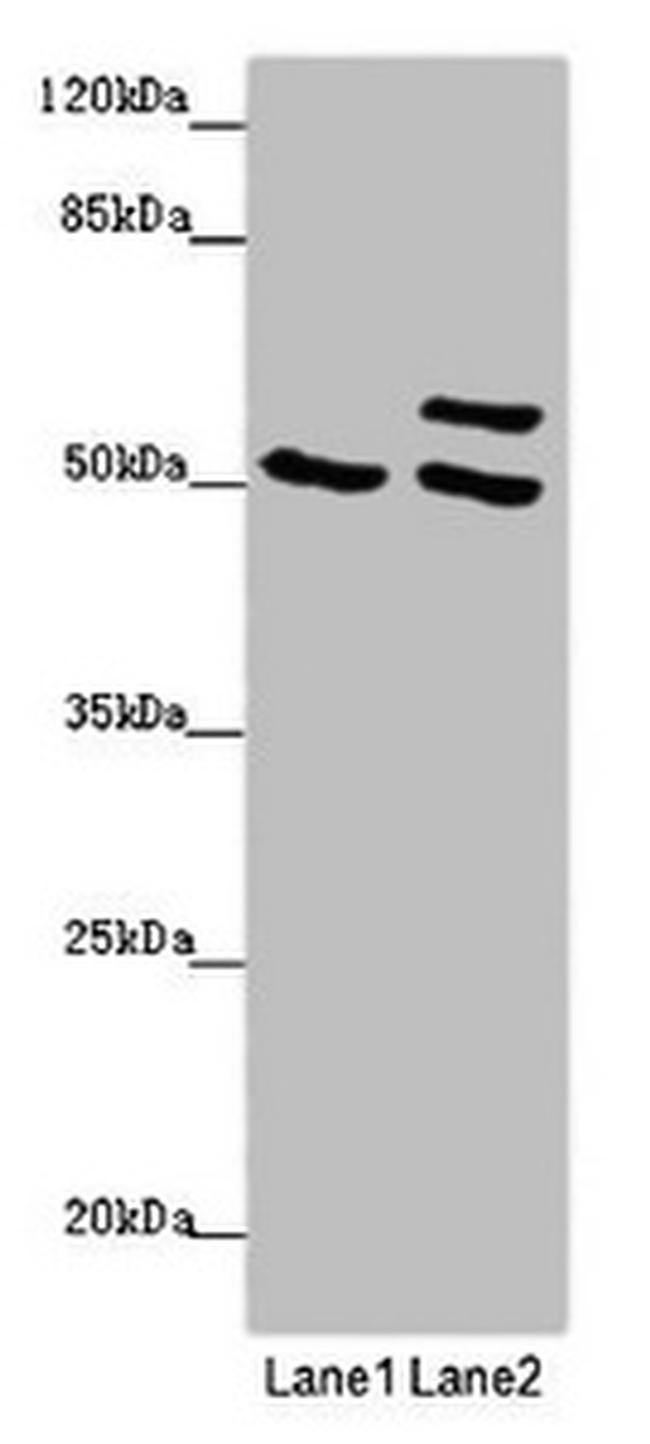 TUBB4A Antibody in Western Blot (WB)