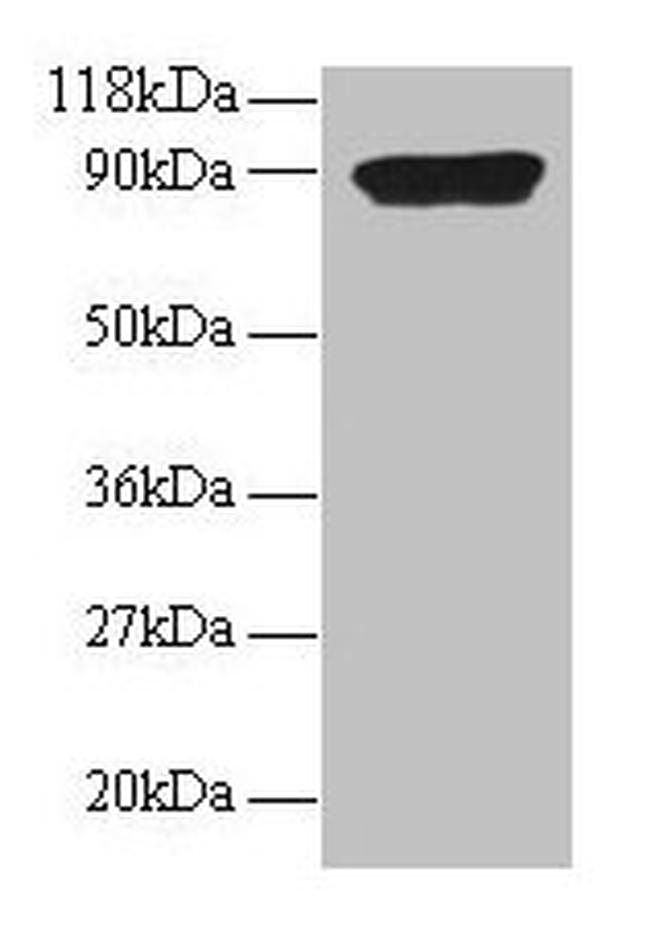 CXCL5 Antibody in Western Blot (WB)