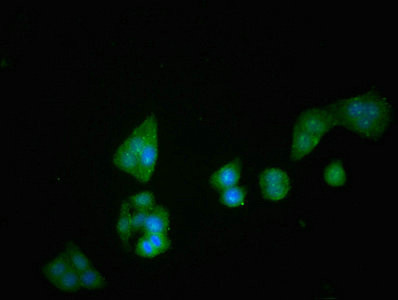 CD26 Antibody in Immunocytochemistry (ICC/IF)