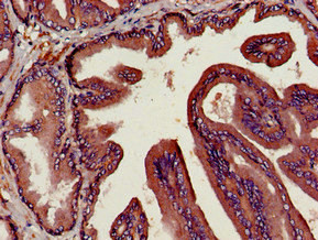 CD26 Antibody in Immunohistochemistry (Paraffin) (IHC (P))