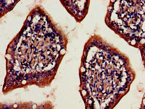 CD26 Antibody in Immunohistochemistry (Paraffin) (IHC (P))