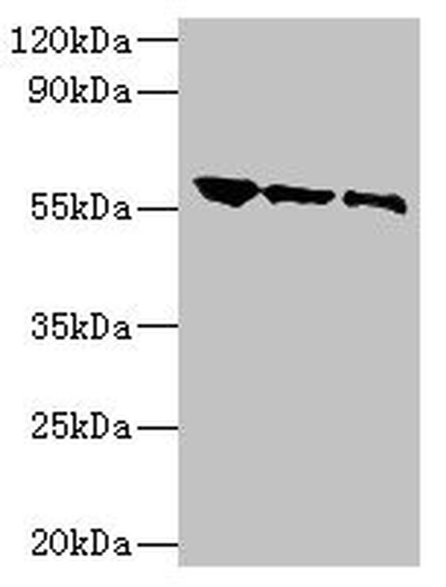 Rabies Virus Glycoprotein Antibody in Western Blot (WB)