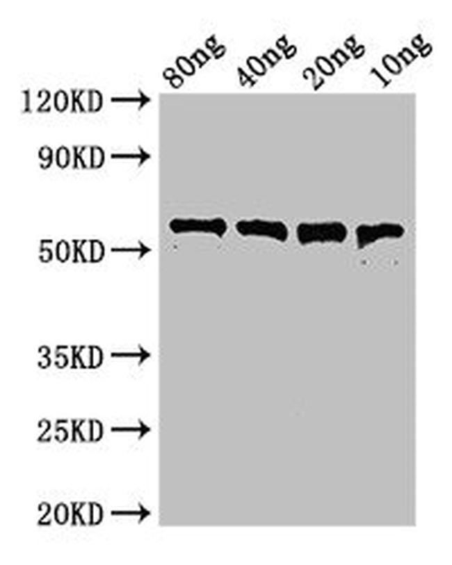 Clostridium perfringens Perfringolysin O Antibody in Western Blot (WB)