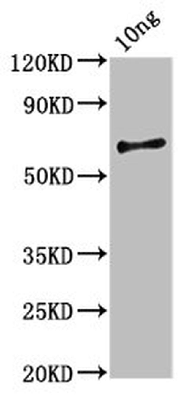 vvhA Antibody in Western Blot (WB)