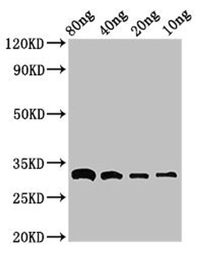 E. coli Beta-lactamase CTX-M-1 Antibody in Western Blot (WB)