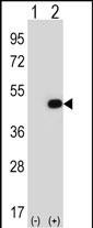 eIF2b gamma Antibody in Western Blot (WB)