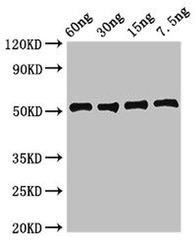 Staphylococcus aureus LDHA Antibody in Western Blot (WB)