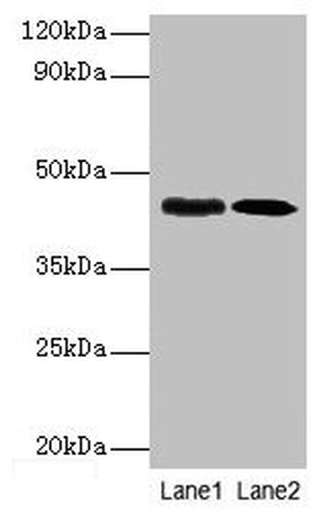 E. coli lapB Antibody in Western Blot (WB)