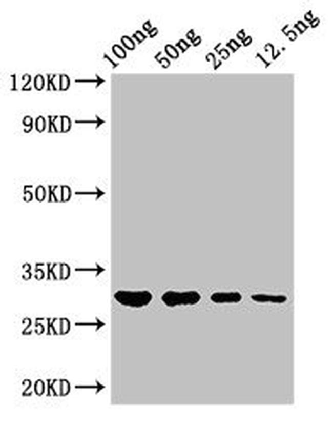 Salmonella typhi hupB Antibody in Western Blot (WB)